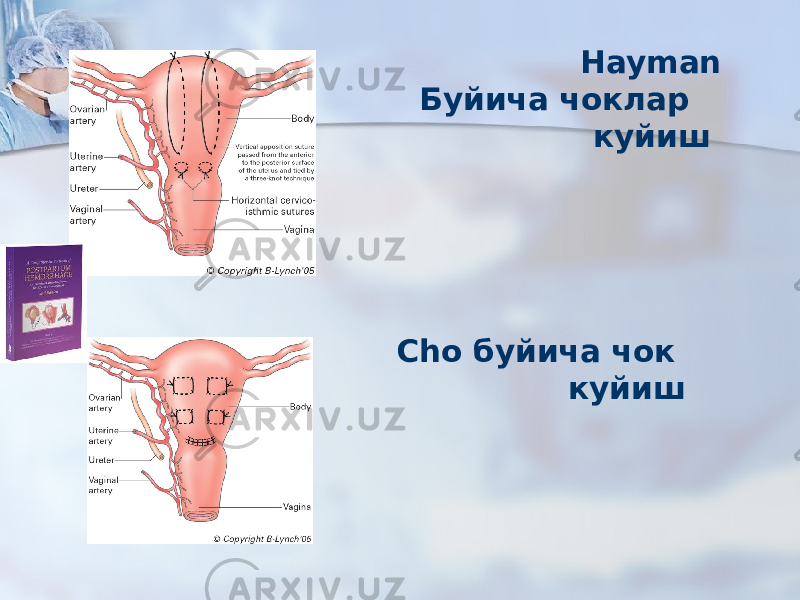  Hayman Буйича чоклар куйиш Cho буйича чок куйиш 