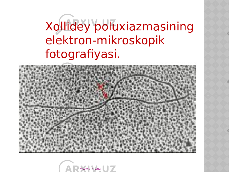 Xollidey poluxiazmasining elektron-mikroskopik fotografiyasi. www.arxiv.uz 