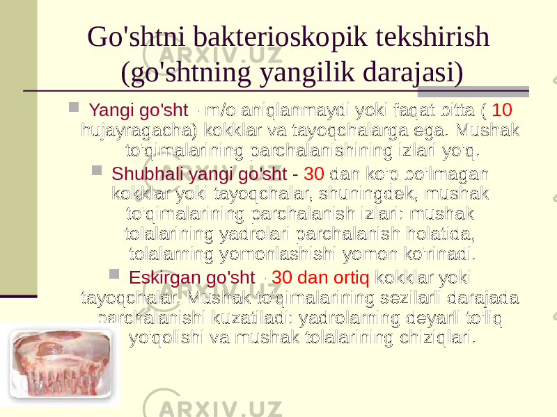 Go&#39;shtni bakterioskopik tekshirish (go&#39;shtning yangilik darajasi)  Yangi go&#39;sht - m/o aniqlanmaydi yoki faqat bitta ( 10 hujayragacha) kokklar va tayoqchalarga ega. Mushak to&#39;qimalarining parchalanishining izlari yo&#39;q.  Shubhali yangi go&#39;sht - 30 dan ko&#39;p bo&#39;lmagan kokklar yoki tayoqchalar, shuningdek, mushak to&#39;qimalarining parchalanish izlari: mushak tolalarining yadrolari parchalanish holatida, tolalarning yomonlashishi yomon ko&#39;rinadi.  Eskirgan go&#39;sht - 30 dan ortiq kokklar yoki tayoqchalar. Mushak to&#39;qimalarining sezilarli darajada parchalanishi kuzatiladi: yadrolarning deyarli to&#39;liq yo&#39;qolishi va mushak tolalarining chiziqlari. 