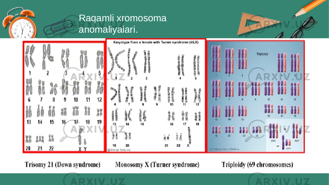 Raqamli xromosoma anomaliyalari. 