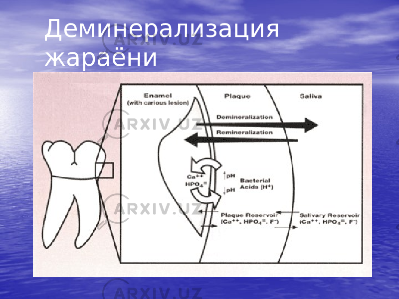 Деминерализация жараёни 