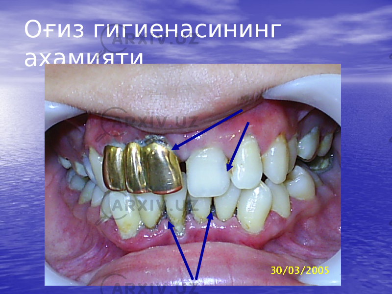 Оғиз гигиенасининг ахамияти 