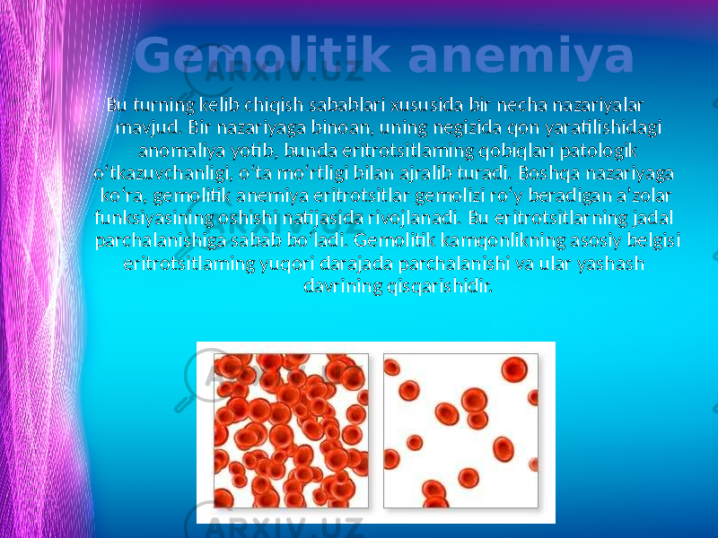 Gemolitik anemiya Bu turning kelib chiqish sabablari xususida bir necha nazariyalar mavjud. Bir nazariyaga binoan, uning negizida qon yaratilishidagi anomaliya yotib, bunda eritrotsitlaming qobiqlari patologik o‘tkazuvchanligi, o‘ta mo‘rtligi bilan ajralib turadi. Boshqa nazariyaga ko‘ra, gemolitik anemiya eritrotsitlar gemolizi ro‘y beradigan a’zolar funksiyasining oshishi natijasida rivojlanadi. Bu eritrotsitlarning jadal parchalanishiga sabab bo‘ladi. Gemolitik kamqonlikning asosiy belgisi eritrotsitlaming yuqori darajada parchalanishi va ular yashash davrining qisqarishidir. www.arxiv.uz 