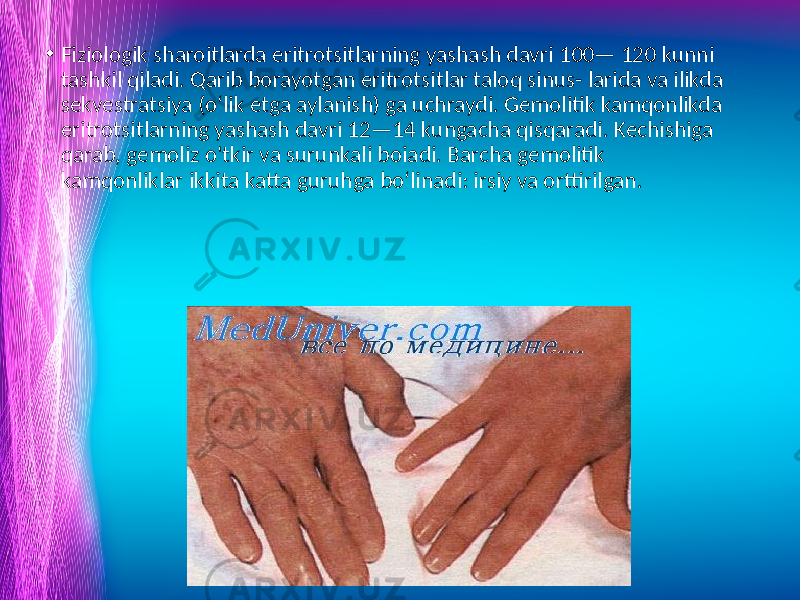 • Fiziologik sharoitlarda eritrotsitlarning yashash davri 100— 120 kunni tashkil qiladi. Qarib borayotgan eritrotsitlar taloq sinus- larida va ilikda sekvestratsiya (o‘lik etga aylanish) ga uchraydi. Gemolitik kamqonlikda eritrotsitlarning yashash davri 12—14 kungacha qisqaradi. Kechishiga qarab, gemoliz o&#39;tkir va surunkali boiadi. Barcha gemolitik kamqonliklar ikkita katta guruhga bo‘linadi: irsiy va orttirilgan. www.arxiv.uz 