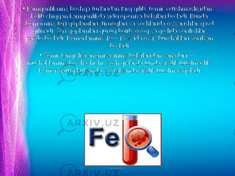 • Kamqonlikning boshqa turlaridan farq qilib, temir yetishmas ligidan kelib chiqqan kamqonlikda sideropeniya belgilari bo‘ladi. Bunda bemorning teri qoplamlari, tirnoqlari va sochlarida o‘zgarishlar qayd qilinadi. Teri qoplamlari quruq boiib, oyoq va qo‘lida yorilishlar paydo bo‘ladi. Bemorlaming 10—15 % ida og‘iz burchaklari yorilgan bo‘ladi. • Temir tanqisligi anemiyasining belgilaridan yana biri — mushaklaming bo‘shashishi, yosh qizlarda tunda siydik tutolmaslik. Bemor qattiq kulganda, yo‘tolganda siydik tutolmay qoladi. www.arxiv.uz 