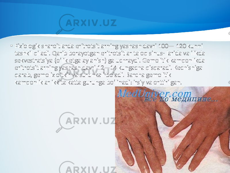 • Fiziologik sharoitlarda eritrotsitlarning yashash davri 100— 120 kunni tashkil qiladi. Qarib borayotgan eritrotsitlar taloq sinus- larida va ilikda sekvestratsiya (o‘lik etga aylanish) ga uchraydi. Gemolitik kamqonlikda eritrotsitlarning yashash davri 12—14 kungacha qisqaradi. Kechishiga qarab, gemoliz o&#39;tkir va surunkali boiadi. Barcha gemolitik kamqonliklar ikkita katta guruhga bo‘linadi: irsiy va orttirilgan. 