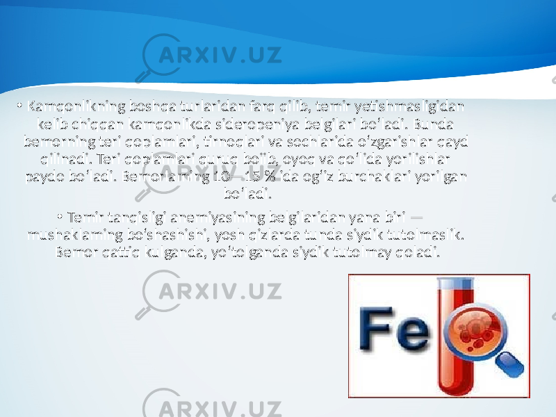 • Kamqonlikning boshqa turlaridan farq qilib, temir yetishmas ligidan kelib chiqqan kamqonlikda sideropeniya belgilari bo‘ladi. Bunda bemorning teri qoplamlari, tirnoqlari va sochlarida o‘zgarishlar qayd qilinadi. Teri qoplamlari quruq boiib, oyoq va qo‘lida yorilishlar paydo bo‘ladi. Bemorlaming 10—15 % ida og‘iz burchaklari yorilgan bo‘ladi. • Temir tanqisligi anemiyasining belgilaridan yana biri — mushaklaming bo‘shashishi, yosh qizlarda tunda siydik tutolmaslik. Bemor qattiq kulganda, yo‘tolganda siydik tutolmay qoladi. 