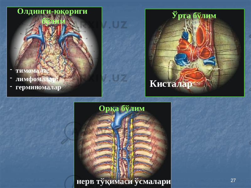 27Олдинги-юқориги бўлим Ўрта бўлим Орқа бўлим- тимомала; - лимфомалар; - герминомалар Кисталар нерв тўқимаси ўсмалари 