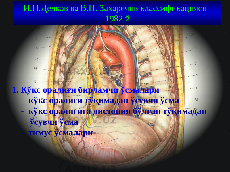 30И.П.Дедков ва В.П. Захаречив классификацияси 1982 й 1. Кўкс оралиғи бирламчи ўсмалари - кўкс оралиғи тўқимадан ўсувчи ўсма - кўкс оралиғига дистопия бўлган тўқимадан ўсувчи ўсма - тимус ўсмалари 