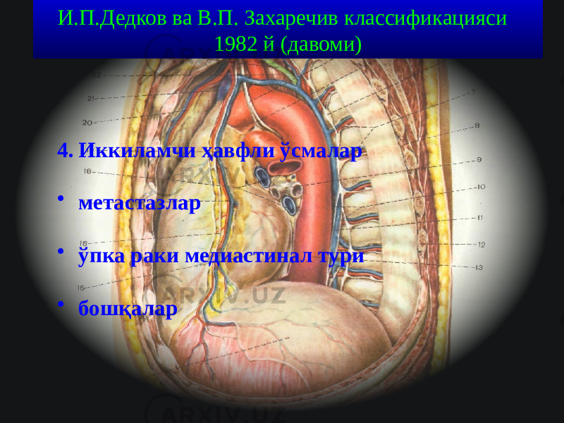 33И.П.Дедков ва В.П. Захаречив классификацияси 1982 й (давоми) 4. Иккиламчи ҳавфли ўсмалар • метастазлар • ўпка раки медиастинал тури • бошқалар 