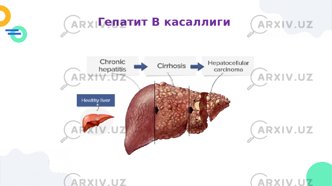 Гепатит В касаллиги 