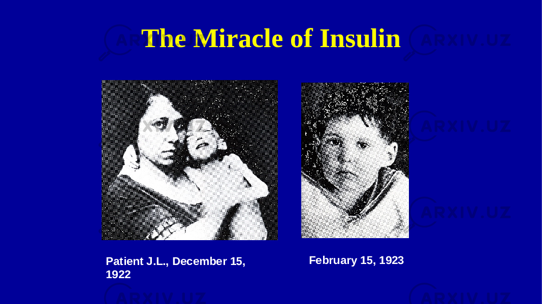 Patient J.L., December 15, 1922 February 15, 1923The Miracle of Insulin 