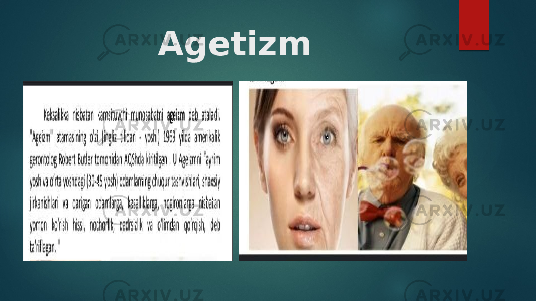 Agetizm 