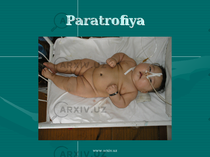 ParatrofiyaParatrofiya www.arxiv.uz 
