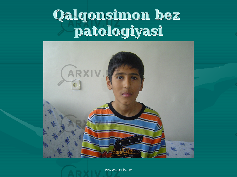 Qalqonsimon bez Qalqonsimon bez patologiyasipatologiyasi www.arxiv.uz 