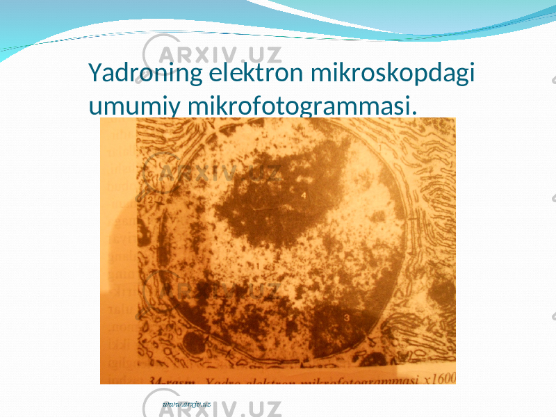 Yadroning elektron mikroskopdagi umumiy mikrofotogrammasi. www.arxiv.uz 