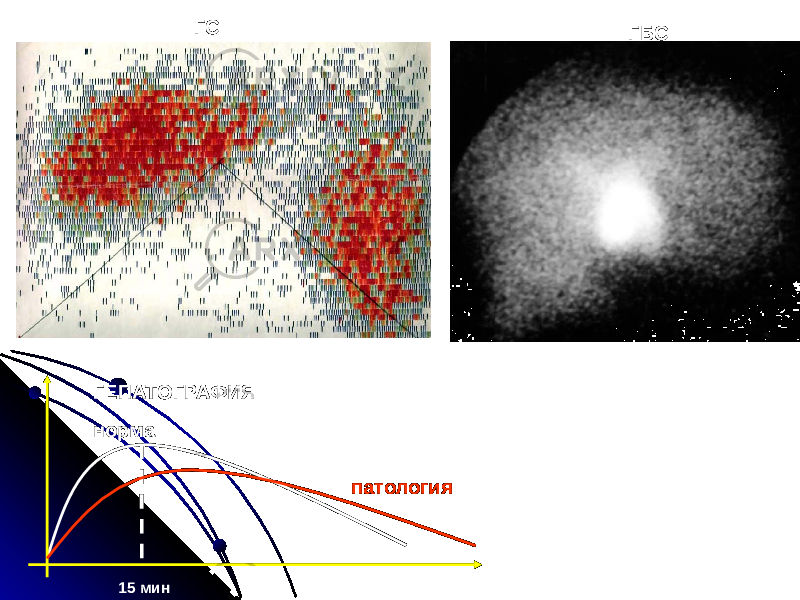 ГС ГБС 15 миннорма патологияГЕПАТОГРАФИЯ 