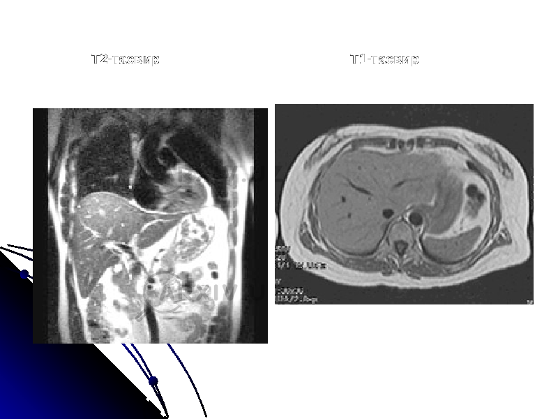 Т2-тасвир Т1-тасвир 