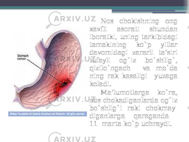 Nos chekishning eng xavfli asorati shundan iboratki, uning tarkibidagi tamakining ko`p yillar davomidagi zararli ta‘siri tufayli og`iz bo`shlig`, qizilo`ngach va me`da ning rak kasaligi yuzaga keladi. Ma‘lumotlarga ko`ra, nos chekadiganlarda og`iz bo`shlig`i raki chekmay- diganlarga qaraganda 11 marta ko`p uchraydi. 