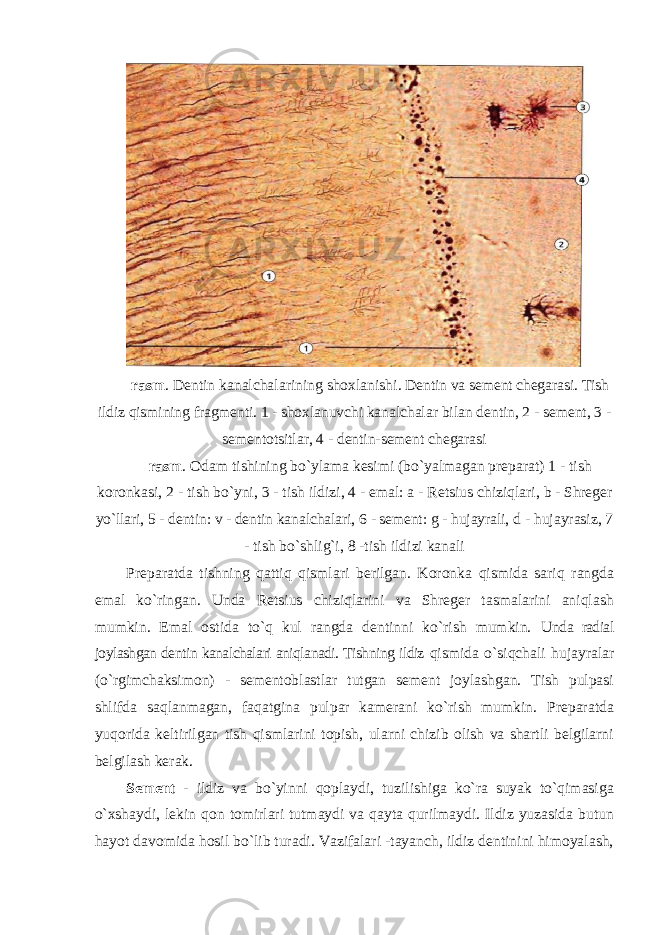 rasm . Dentin kanalchalarining sho х lanishi. Dentin va sement chegarasi. Tish ildiz qismining fragmenti. 1 - sho х lanuvchi kanalchalar bilan dentin, 2 - sement, 3 - sementotsitlar, 4 - dentin-sement chegarasi rasm . Odam tishining bo`ylama kesimi (bo`yalmagan preparat) 1 - tish koronkasi, 2 - tish bo`yni, 3 - tish ildizi, 4 - emal: a - Retsius chiziqlari, b - Shreger yo`llari, 5 - dentin: v - dentin kanalchalari, 6 - sement: g - hujayrali, d - hujayrasiz, 7 - tish bo`shlig`i, 8 -tish ildizi kanali Preparatda tishning qattiq qismlari berilgan. Koronka qismida sariq rangda emal ko`ringan. Unda Retsius chiziqlarini va Shreger tasmalarini aniqlash mumkin. Emal ostida to`q kul rangda dentinni ko`rish mumkin. Unda radial joylashgan dentin kanalchalari aniqlanadi. Tishning ildiz qismida o`siqchali hujayralar (o`rgimchaksimon) - sementoblastlar tutgan sement joylashgan. Tish pulpasi shlifda saqlanmagan, faqatgina pulpar kamerani ko`rish mumkin. Preparatda yuqorida keltirilgan tish qismlarini topish, ularni chizib olish va shartli belgilarni belgilash kerak. Sement - ildiz va bo`yinni qoplaydi, tuzilishiga ko`ra suyak to`qimasiga o` х shaydi, lekin qon tomirlari tutmaydi va qayta qurilmaydi. Ildiz yuzasida butun hayot davomida hosil bo`lib turadi. Vazifalari -tayanch, ildiz dentinini himoyalash, 