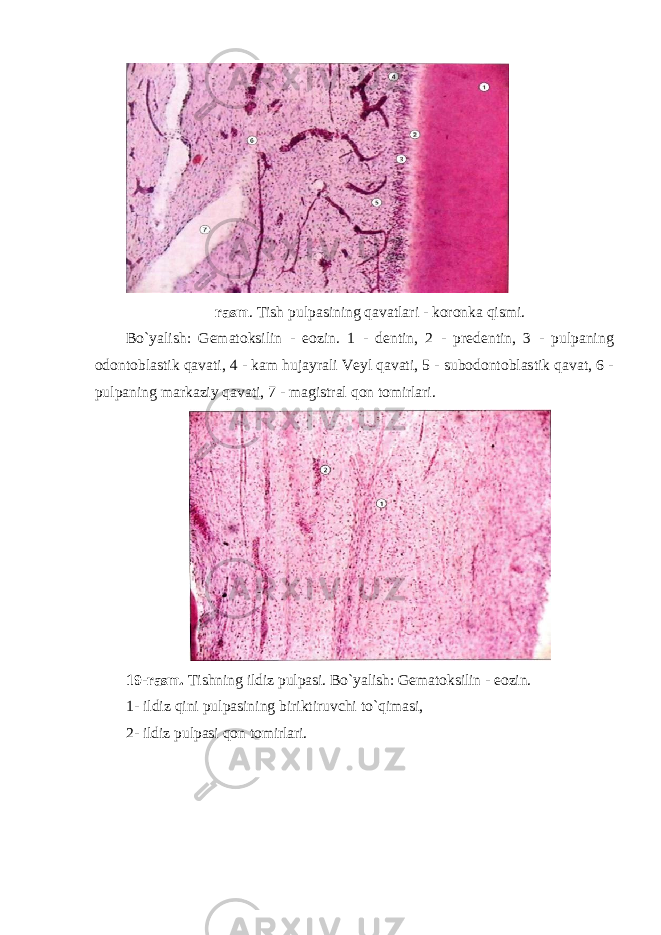 rasm . Tish pulpasining qavatlari - koronka qismi. Bo`yalish: Gematoksilin - eozin. 1 - dentin, 2 - predentin, 3 - pulpaning odontoblastik qavati, 4 - kam hujayrali Veyl qavati, 5 - subodontoblastik qavat, 6 - pulpaning markaziy qavati, 7 - magistral qon tomirlari. 19-rasm. Tishning ildiz pulpasi. Bo`yalish: Gematoksilin - eozin. 1 - ildiz qini pulpasining biriktiruvchi to`qimasi, 2 - ildiz pulpasi qon tomirlari. 