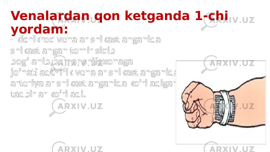 Venalardan qon ketganda 1-chi yordam: - kichikroq venalar shikastlanganida shikastlangan tomir siqib bog’lanib,bemor shifoxonaga jo’natiladi.Yirik venalar shikastlanganida arteriyalar shikastlanganida ko’riladigan tadbirlar ko’riladi. 