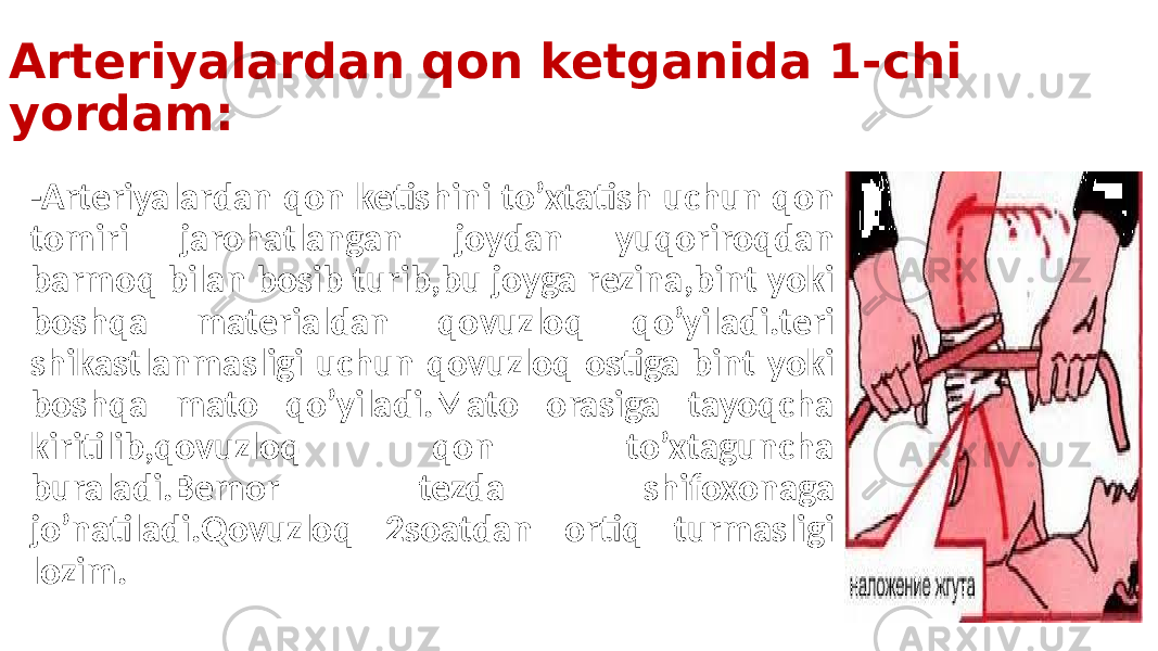 Arteriyalardan qon ketganida 1-chi yordam: -Arteriyalardan qon ketishini to’xtatish uchun qon tomiri jarohatlangan joydan yuqoriroqdan barmoq bilan bosib turib,bu joyga rezina,bint yoki boshqa materialdan qovuzloq qo’yiladi.teri shikastlanmasligi uchun qovuzloq ostiga bint yoki boshqa mato qo’yiladi.Mato orasiga tayoqcha kiritilib,qovuzloq qon to’xtaguncha buraladi.Bemor tezda shifoxonaga jo’natiladi.Qovuzloq 2soatdan ortiq turmasligi lozim. 