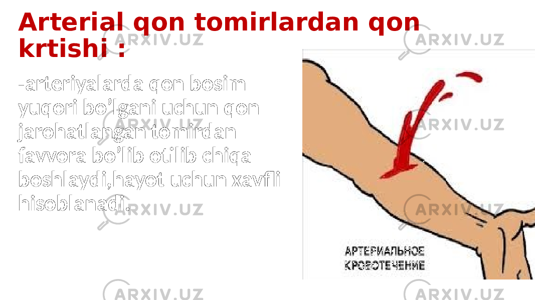 Arterial qon tomirlardan qon krtishi : -arteriyalarda qon bosim yuqori bo’lgani uchun qon jarohatlangan tomirdan favvora bo’lib otilib chiqa boshlaydi,hayot uchun xavfli hisoblanadi. 