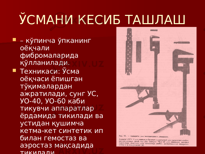 ЎСМАНИ КЕСИБ ТАШЛАШ  – кўпинча ўпканинг оёқчали фибромаларида қўлланилади.  Техникаси: Ўсма оёқчаси ёпишган тўқималардан ажратилади, сунг УС, УО-40, УО-60 каби тикувчи аппаратлар ёрдамида тикилади ва устидан қушимча кетма-кет синтетик ип билан гемостаз ва аэростаз мақсадида тикилади. 