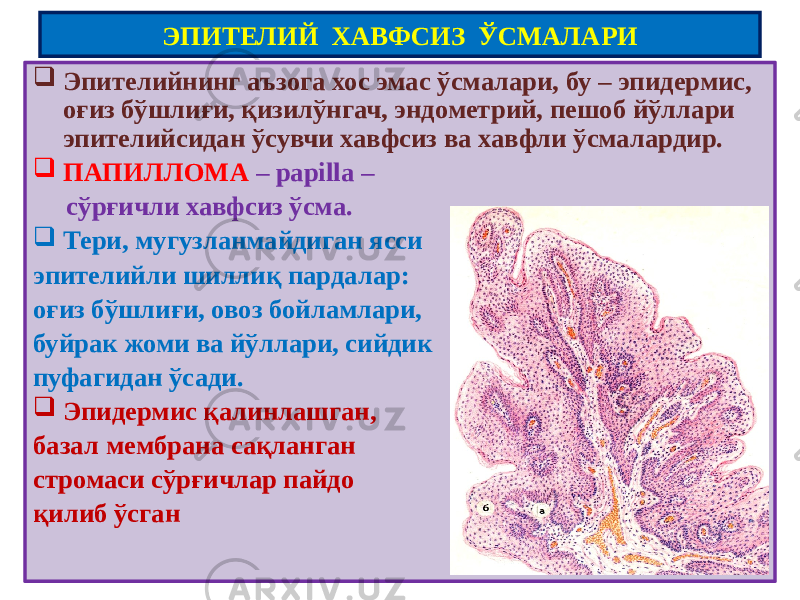 ЭПИТЕЛИЙ ХАВФСИЗ ЎСМАЛАРИ  Эпителийнинг аъзога хос эмас ўсмалари, бу – эпидермис, оғиз бўшлиғи, қизилўнгач, эндометрий, пешоб йўллари эпителийсидан ўсувчи хавфсиз ва хавфли ўсмалардир.  ПАПИЛЛОМА – papilla – сўрғичли хавфсиз ўсма.  Тери, мугузланмайдиган ясси эпителийли шиллиқ пардалар: оғиз бўшлиғи, овоз бойламлари, буйрак жоми ва йўллари, сийдик пуфагидан ўсади.  Эпидермис қалинлашган, базал мембрана сақланган стромаси сўрғичлар пайдо қилиб ўсган 