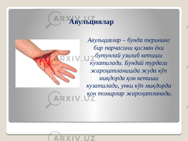 Авульциялар – бунда терининг бир парчасини қисман ёки бутунлай узилиб кетиши кузатилади. Бундай турдаги жароҳатланишда жуда кўп миқдорда қон кетиши кузатилади, унки кўп миқдорда қон томирлар жароҳатланади. Авульциялар 