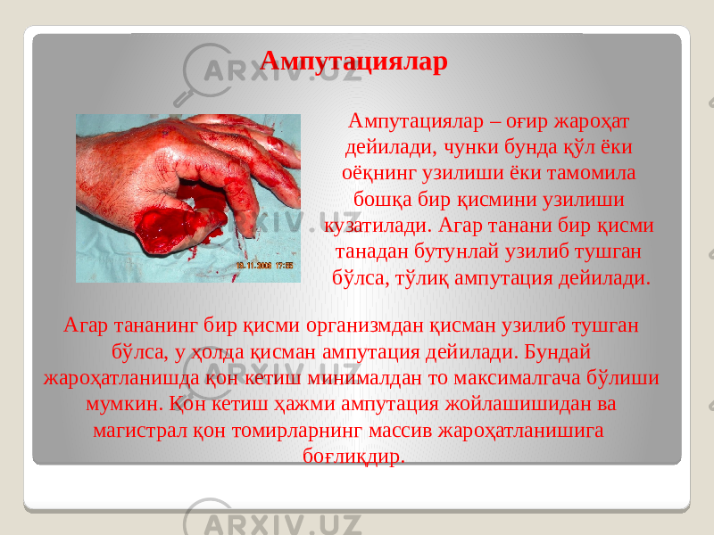 Ампутациялар – оғир жароҳат дейилади, чунки бунда қўл ёки оёқнинг узилиши ёки тамомила бошқа бир қисмини узилиши кузатилади. Агар танани бир қисми танадан бутунлай узилиб тушган бўлса, тўлиқ ампутация дейилади. Ампутациялар Агар тананинг бир қисми организмдан қисман узилиб тушган бўлса, у ҳолда қисман ампутация дейилади. Бундай жароҳатланишда қон кетиш минималдан то максималгача бўлиши мумкин. Қон кетиш ҳажми ампутация жойлашишидан ва магистрал қон томирларнинг массив жароҳатланишига боғлиқдир. 