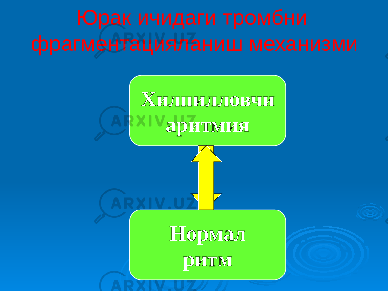 Юрак ичидаги тромбни фрагментацияланиш механизми Хилпилловчи аритмия Нормал ритм 