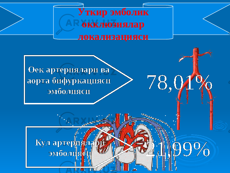 Оек артериялари ва аорта бифуркацияси эмболияси 78,01% Кул артериялари эмболияси 21,99%Уткир эмболик окклюзиялар локализацияси 