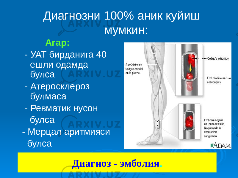  Диагнозни 100% аник куйиш мумкин: Агар: - УАТ бирданига 40 ешли одамда булса - Атеросклероз булмаса - Ревматик нусон булса - Мерцал аритмияси булса Диагноз - эмболия . 