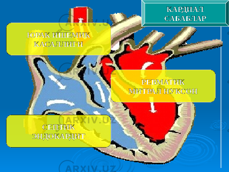 ЮРАК ИШЕМИК КАСАЛЛИГИ РЕВМАТИК МИТРАЛ НУКСОН СЕПТИК ЭНДОКАРДИТ КАРДИАЛ САБАБЛАР 