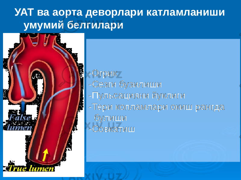 УАТ ва аорта деворлари катламланиши умумий белгилари -Огрик -Сезги бузилиши -Пульсацияни йуклиги -Тери копламлари окиш рангда булиши -Совкатиш 