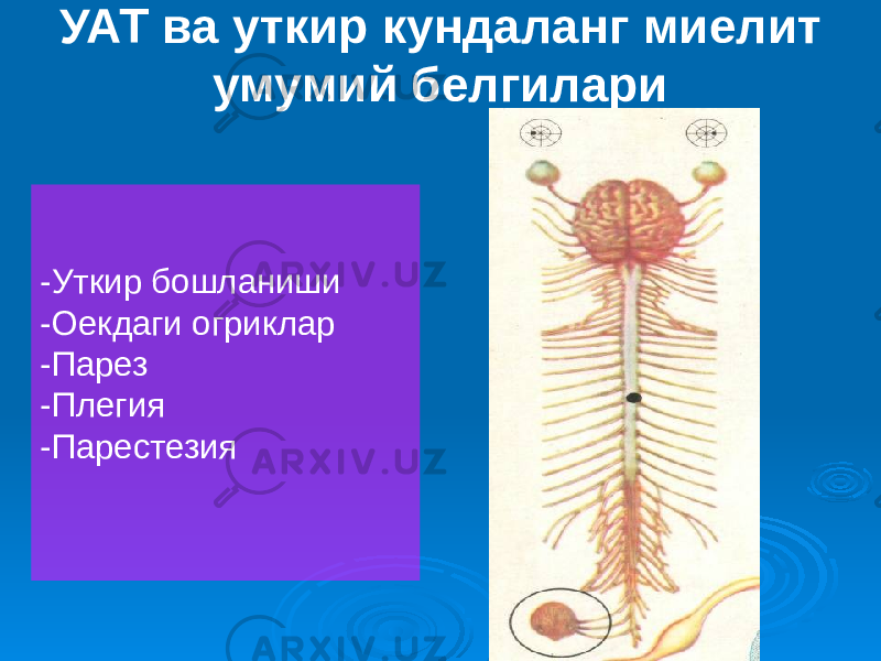 УАТ ва уткир кундаланг миелит умумий белгилари -Уткир бошланиши -Оекдаги огриклар -Парез -Плегия -Парестезия 