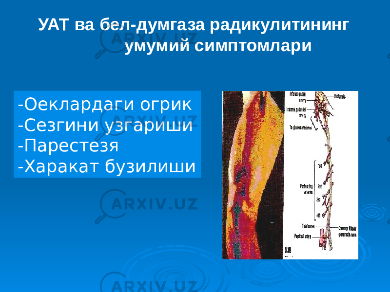  УАТ ва бел-думгаза радикулитининг умумий симптомлари -Оеклардаги огрик -Сезгини узгариши -Парестезя -Харакат бузилиши 