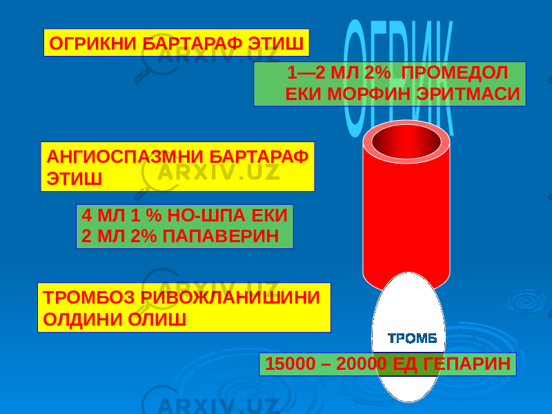 ОГРИКНИ БАРТАРАФ ЭТИШ АНГИОСПАЗМНИ БАРТАРАФ ЭТИШ ТРОМБОЗ РИВОЖЛАНИШИНИ ОЛДИНИ ОЛИШ 1—2 МЛ 2% ПРОМЕДОЛ ЕКИ МОРФИН ЭРИТМАСИ 4 МЛ 1 % НО-ШПА ЕКИ 2 МЛ 2% ПАПАВЕРИН ТРОМБ 15000 – 20000 ЕД ГЕПАРИН 