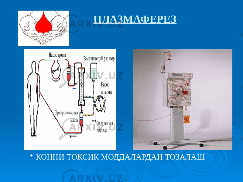 ПЛАЗМАФЕРЕЗ • КОННИ ТОКСИК МОДДАЛАРДАН ТОЗАЛАШ 