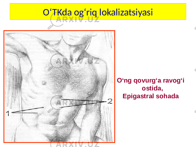 O‘TKda og‘riq lokalizatsiyasi O‘ng qovurg‘a ravog‘i ostida, Epigastral sohada 