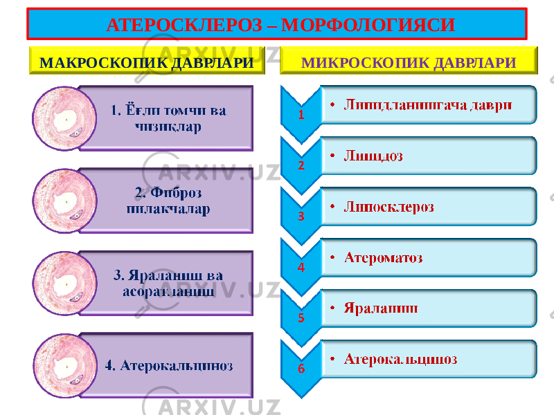 МАКРОСКОПИК ДАВРЛАРИ МИКРОСКОПИК ДАВРЛАРИ АТЕРОСКЛЕРОЗ – МОРФОЛОГИЯСИ 