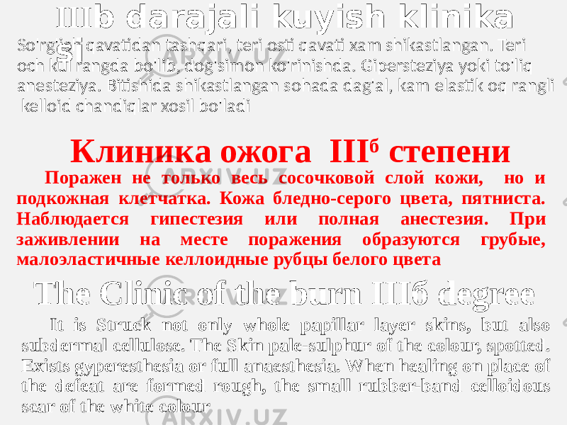  III b darajali kuyish klinika siSo&#39;rg&#39;ich qavatidan tashqari, teri osti qavati xam shikastlangan. Teri  och kul rangda bo&#39;lib, dog&#39;simon ko&#39;rinishda. Gipersteziya yoki to&#39;liq  anesteziya. Bitishida shikastlangan sohada dag&#39;al, kam elastik oq rangli  kelloid chandiqlar xosil bo&#39;ladi Клиника ожога III б степени Поражен не только весь сосочковой слой кожи, но и подкожная клетчатка. Кожа бледно-серого цвета, пятниста. Наблюдается гипестезия или полная анестезия. При заживлении на месте поражения образуются грубые, малоэластичные келлоидные рубцы белого цвета The Clinic of the burn IIIб degree It is Struck not only whole papillar layer skins, but also subdermal cellulose. The Skin pale-sulphur of the colour, spotted. Exists gyperesthesia or full anaesthesia. When healing on place of the defeat are formed rough, the small rubber-band celloidous scar of the white colour 