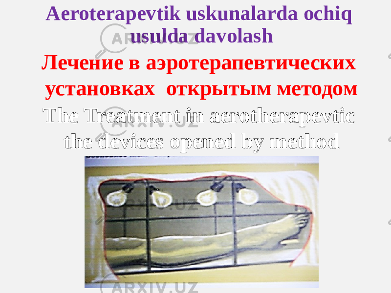 Aeroterapevtik uskunalarda ochiq usulda davolash Лечение в аэротерапевтических установках открытым методом The Treatment in aerotherapevtic the devices opened by method 