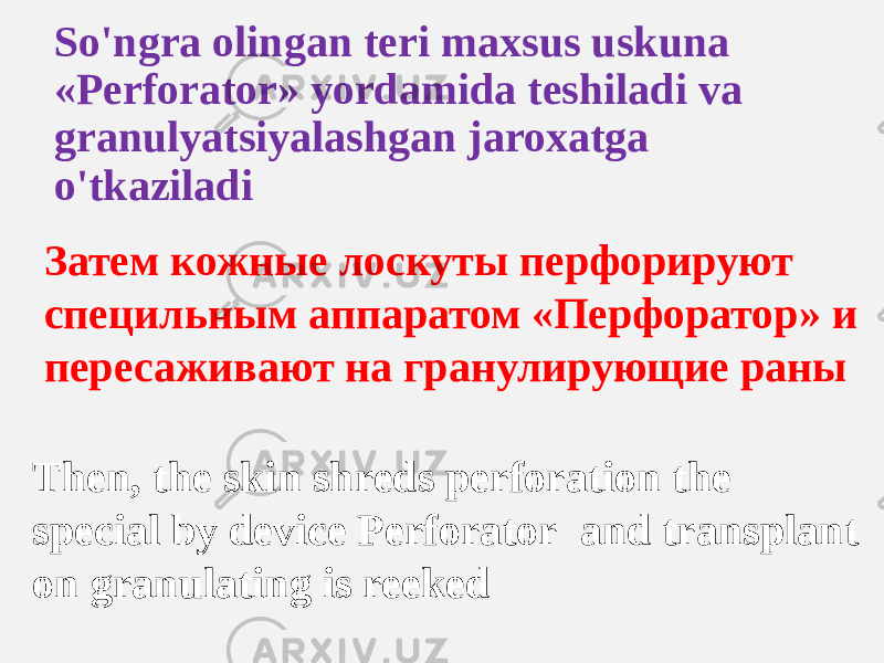 So&#39;ngra olingan teri maxsus uskuna «Perforator» yordamida teshiladi va granulyatsiyalashgan jaroxatga o&#39;tkaziladi Затем кожные лоскуты перфорируют специльным аппаратом «Перфоратор» и пересаживают на гранулирующие раны Then, the skin shreds perforation the special by device Perforator and transplant on granulating is reeked 