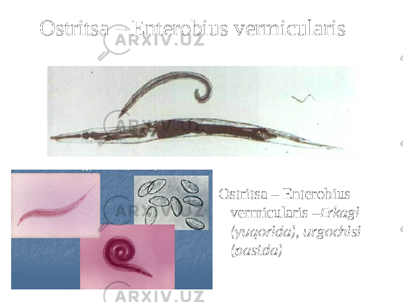Ostritsa – Enterobius vermicularis   Ostritsa – Enterobius vermicularis – Erkagi (yuqorida), urgochisi (pastda) 