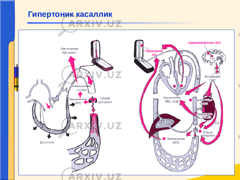 Гипертоник касаллик 