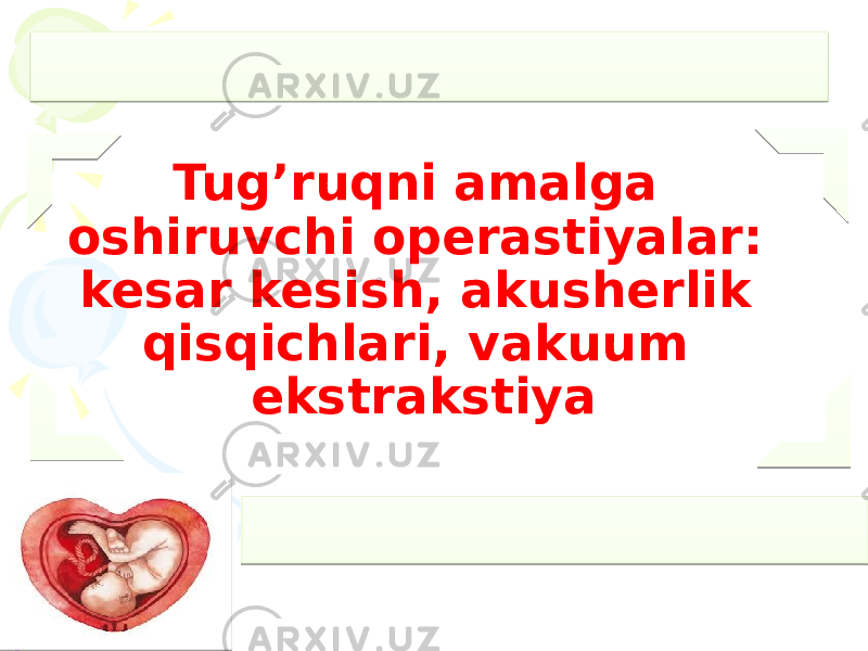 Tug’ruqni amalga oshiruvchi operastiyalar: kesar kesish, akusherlik qisqichlari, vakuum ekstrakstiya 