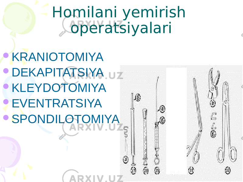 Homilani yemirish operatsiyalari  KRANIOTOMIYA  DEKAPITATSIYA  KLEYDOTOMIYA  EVENTRATSIYA  SPONDILOTOMIYA 